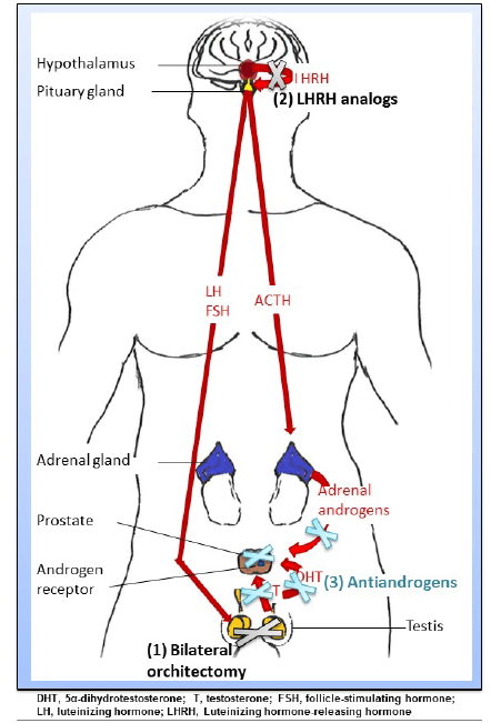 Source NIH - How  androgen deprivation works